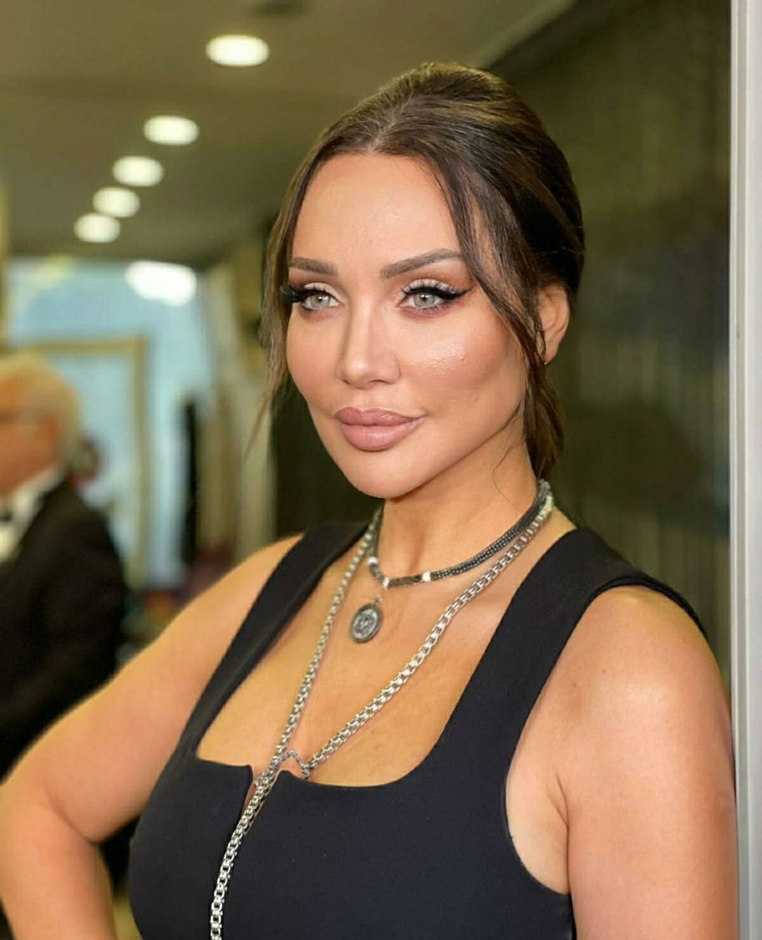 Türkiye'nin Angelina Jolie'si Umut Akyürek estetiği abarttı! Gün geçtikçe gençleşiyor 18