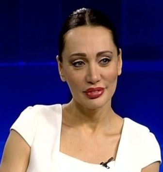 Türkiye'nin Angelina Jolie'si Umut Akyürek estetiği abarttı! Gün geçtikçe gençleşiyor 2