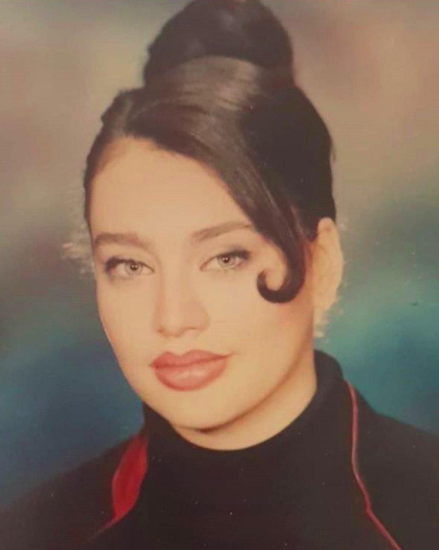 Türkiye'nin Angelina Jolie'si Umut Akyürek estetiği abarttı! Gün geçtikçe gençleşiyor 11