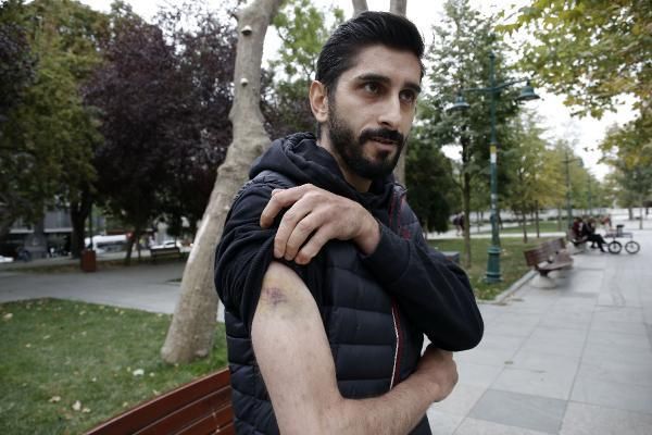 Doktor kız arkadaşı hayatını zindana çevirdi! "Cinsel organlarıyla taciz ettiler" 2