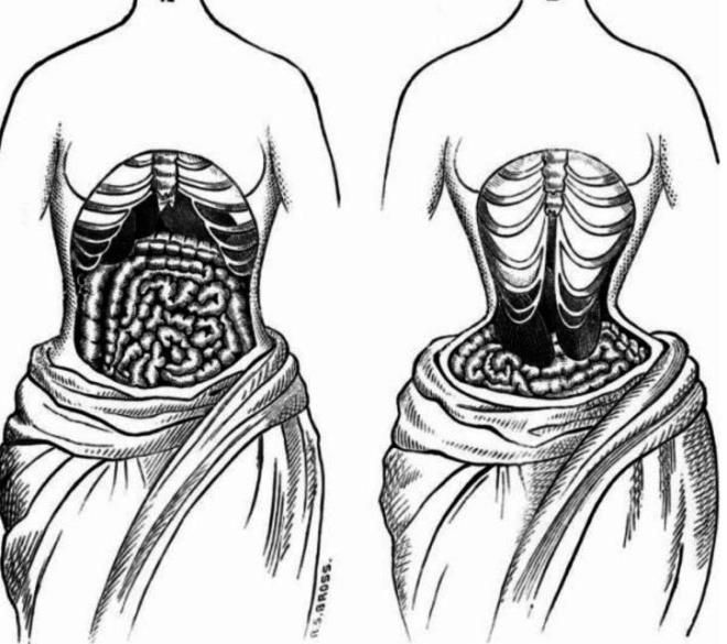 Güzel görünmek uğruna pek çok insan hayatını kaybetti! İşte ölümcül moda akımı... 6