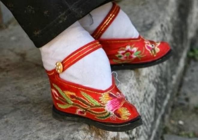 Güzel görünmek uğruna pek çok insan hayatını kaybetti! İşte ölümcül moda akımı... 8