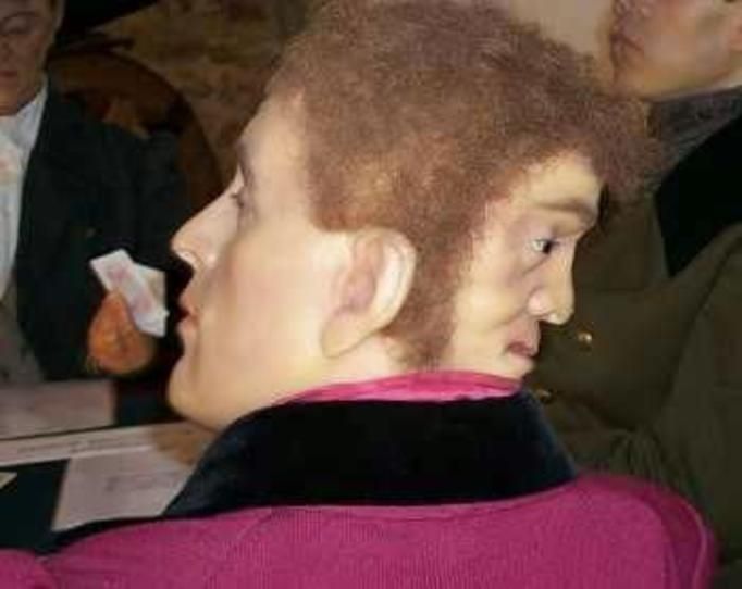 Dünya yeniden onu konuşmaya başladı! Kafasının arkasında başka bir yüzle doğdu! 3