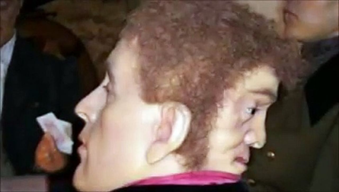 Dünya yeniden onu konuşmaya başladı! Kafasının arkasında başka bir yüzle doğdu! 7