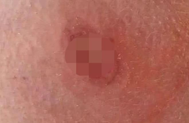 Klozete oturan kadın hayatının şokunu yaşadı! Gördükleri karşısında neye uğradığını şaşırdı... 6