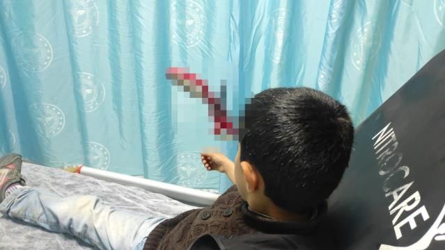 Böyle şaka olmaz olsun! Hastaneye kafasında makasla geldi... 3