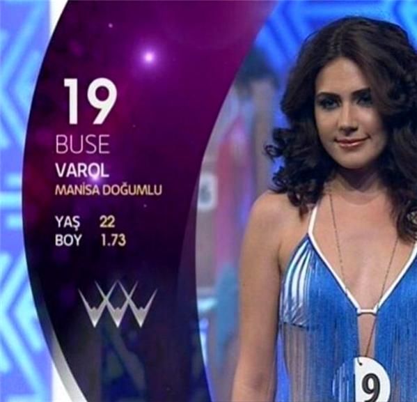 Alişan eşi Buse Varol'un estetiksiz fotoğraflarını ifşa etti! 4