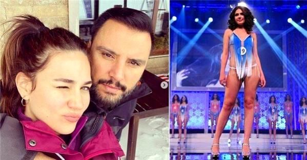 Alişan eşi Buse Varol'un estetiksiz fotoğraflarını ifşa etti! 5