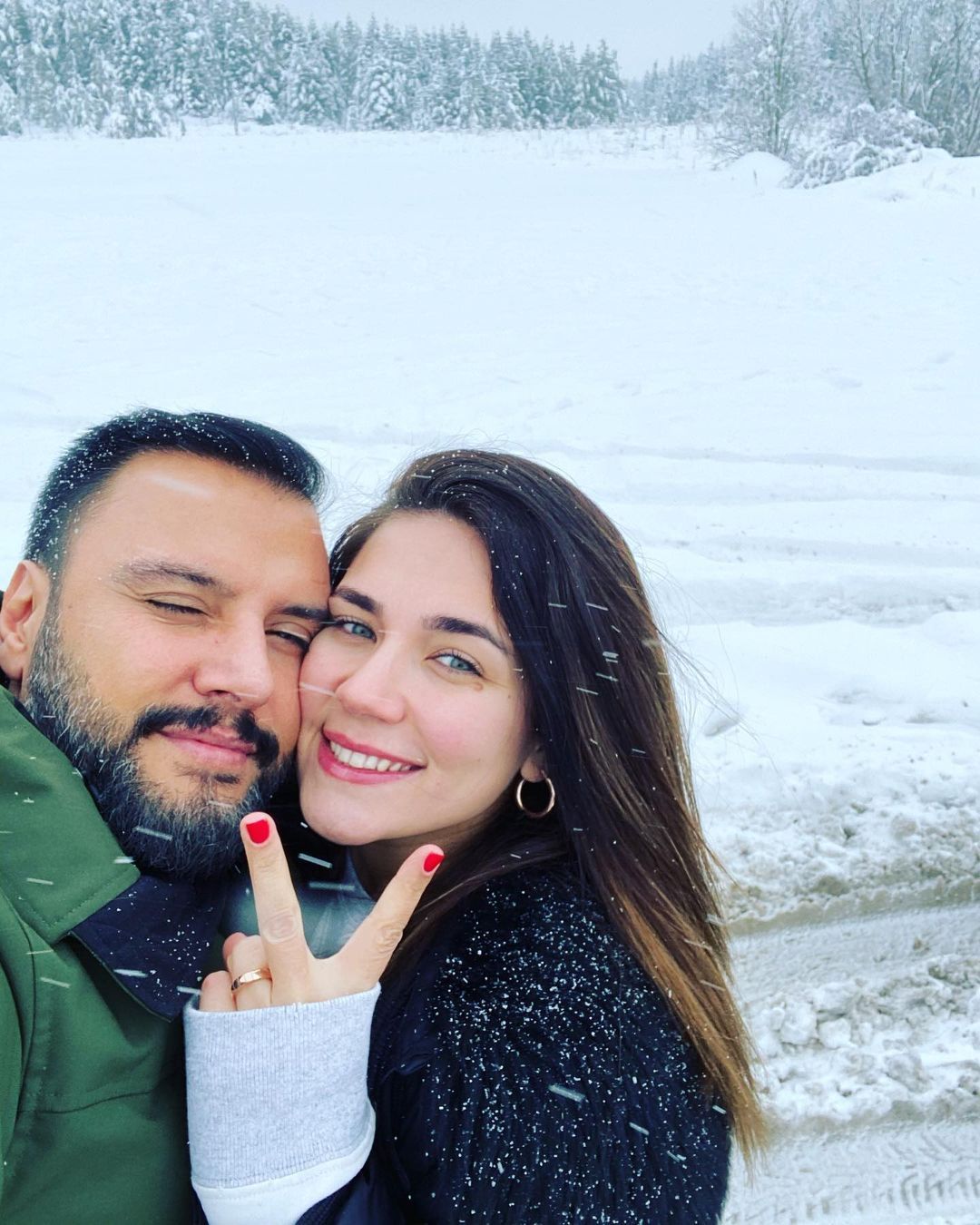 Alişan'ın eşi Buse Varol estetik harikası çıktı! Yıllar önceki hali görenleri şoke etti 2