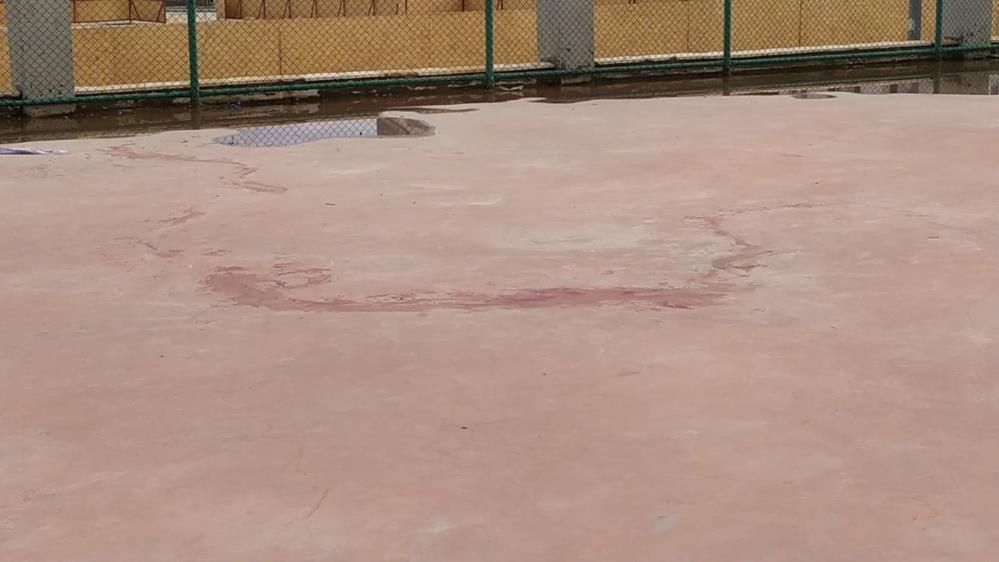 Gaziantep'teki Pitbull dehşetinde sıcak gelişme! Valilik duyurdu! Gözaltı sayısı arttı! 2