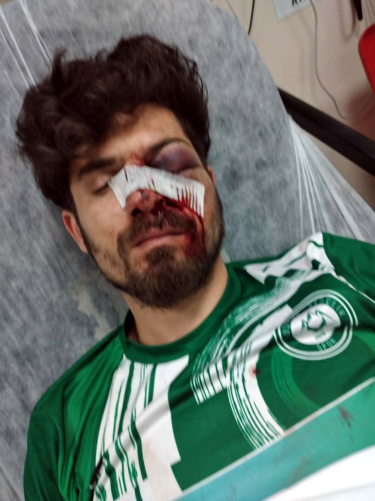 Kırmızı kart gören futbolcudan cinayete teşebbüs! Amatör futbolcu Umut Karakaş tedavi altında... 3