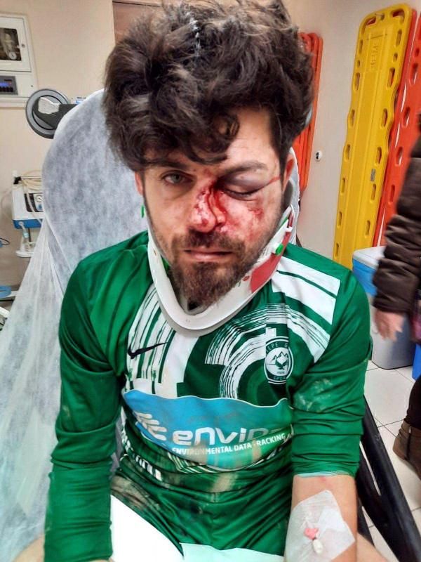 Kırmızı kart gören futbolcudan cinayete teşebbüs! Amatör futbolcu Umut Karakaş tedavi altında... 1