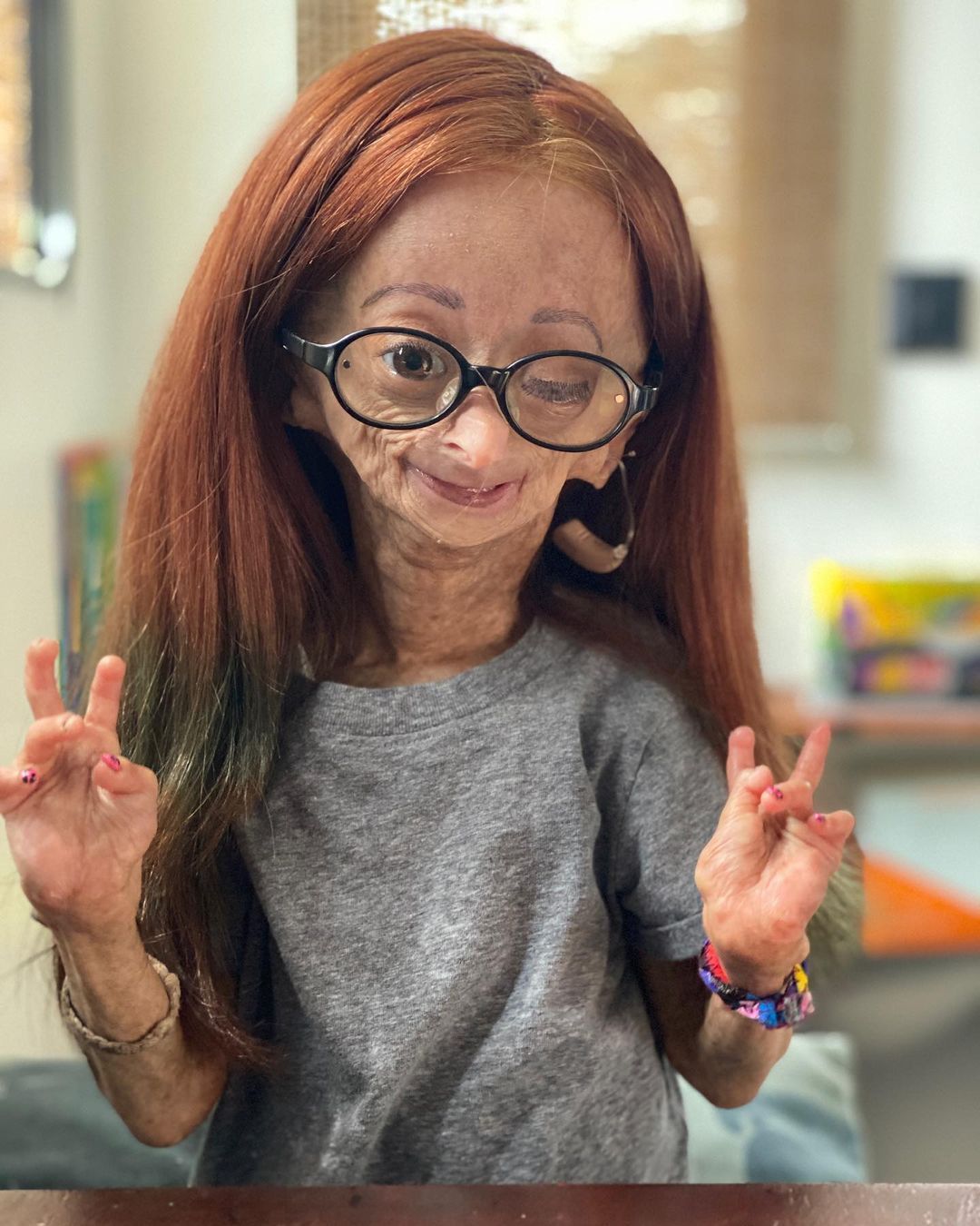 Erken yaşlanan ünlü Youtuber'dan acı haber! Adalia Rose Williams 15 yaşında hayatını kaybetti 10