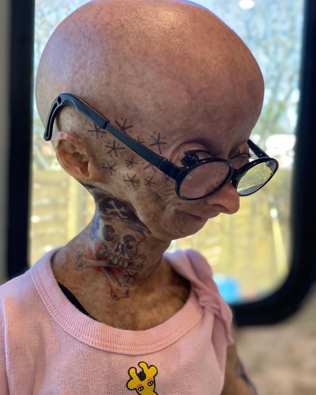 Erken yaşlanan ünlü Youtuber'dan acı haber! Adalia Rose Williams 15 yaşında hayatını kaybetti 13