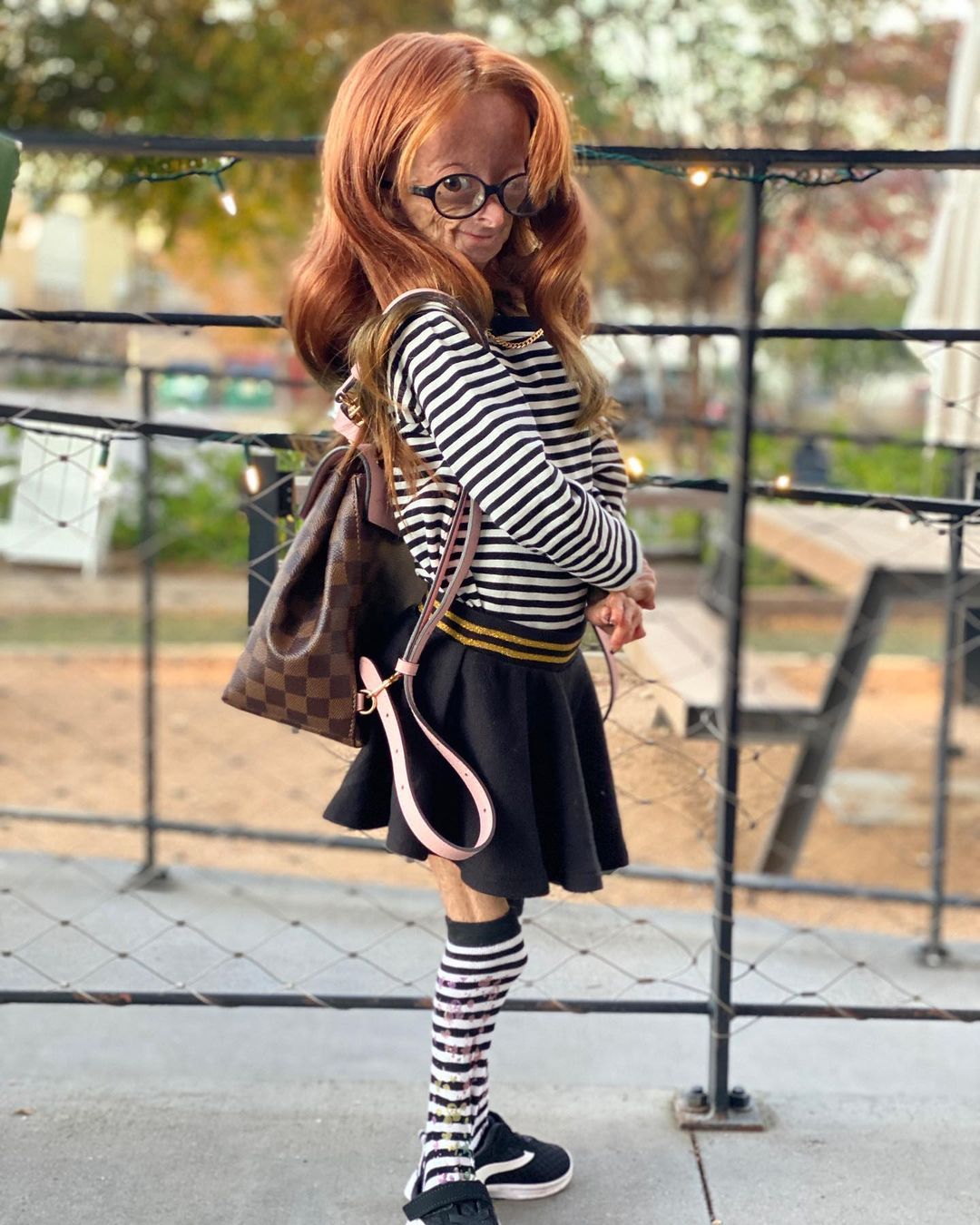 Erken yaşlanan ünlü Youtuber'dan acı haber! Adalia Rose Williams 15 yaşında hayatını kaybetti 14