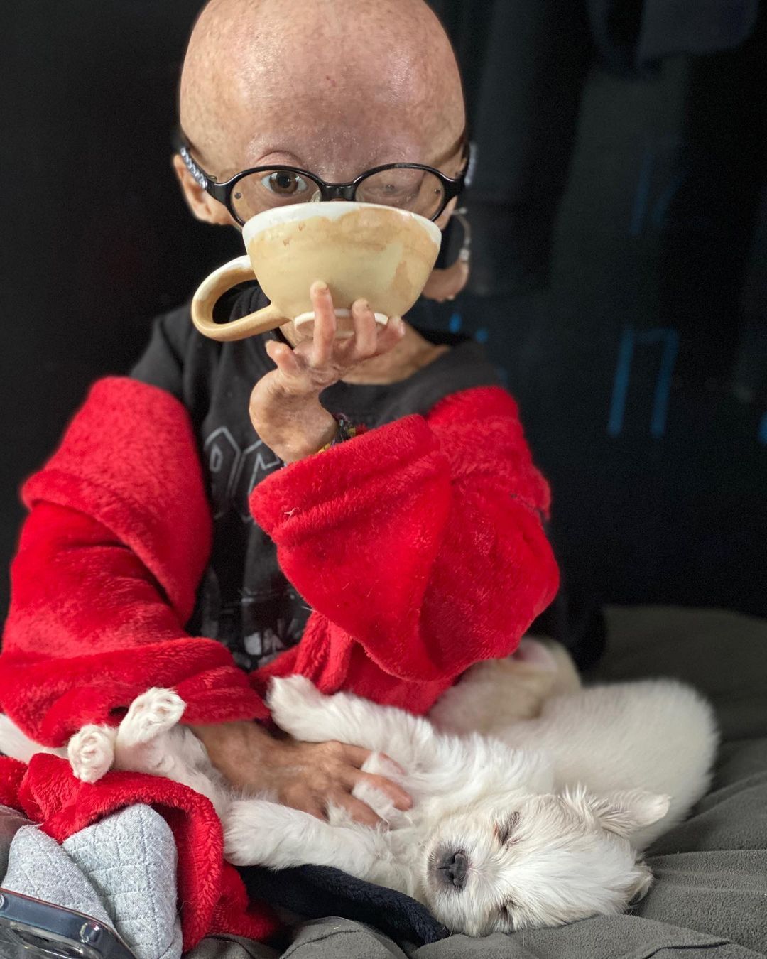 Erken yaşlanan ünlü Youtuber'dan acı haber! Adalia Rose Williams 15 yaşında hayatını kaybetti 15
