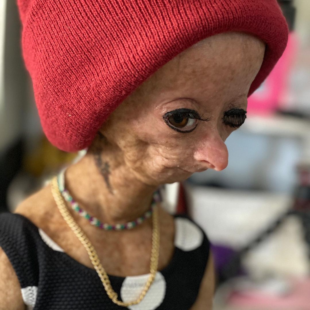 Erken yaşlanan ünlü Youtuber'dan acı haber! Adalia Rose Williams 15 yaşında hayatını kaybetti 16