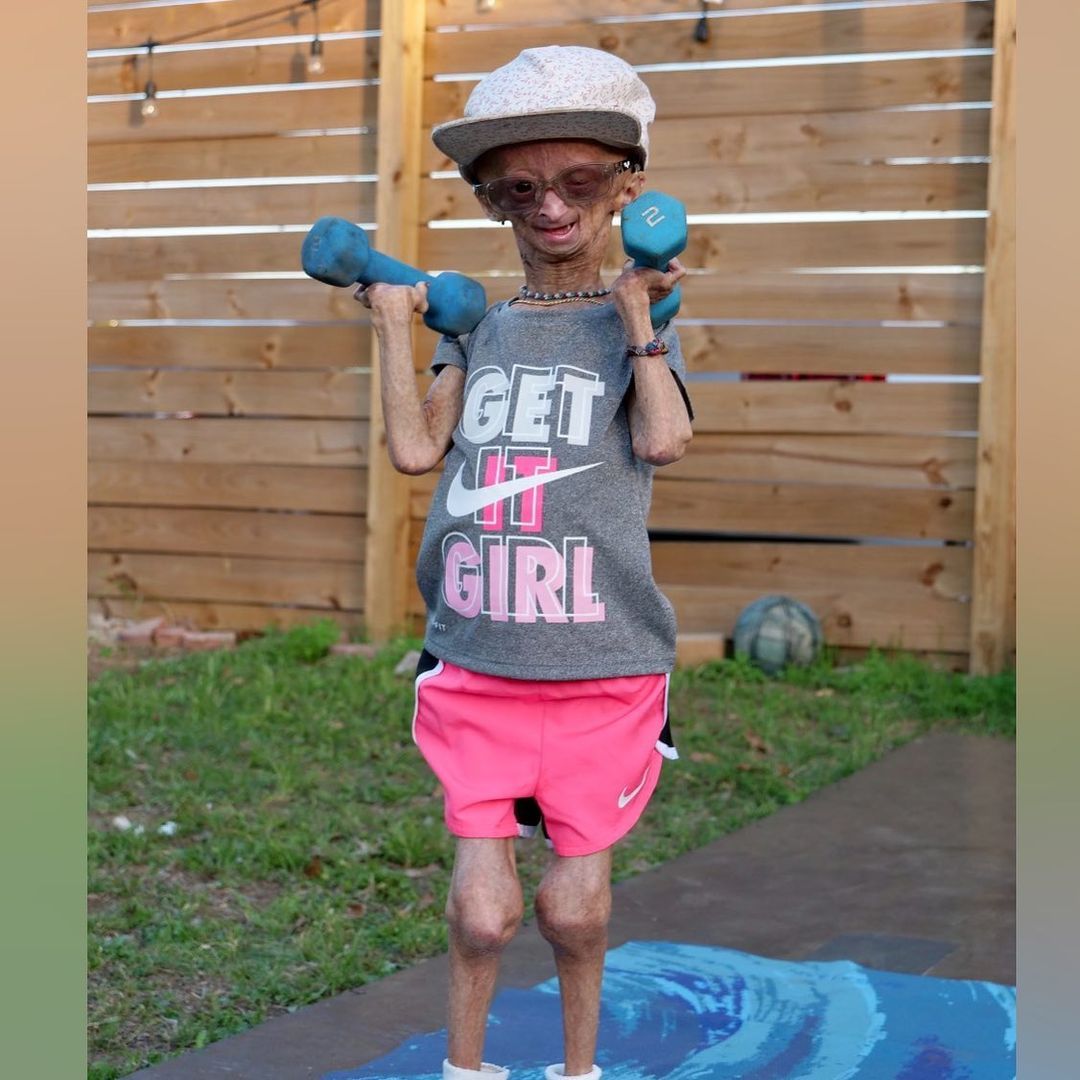 Erken yaşlanan ünlü Youtuber'dan acı haber! Adalia Rose Williams 15 yaşında hayatını kaybetti 20