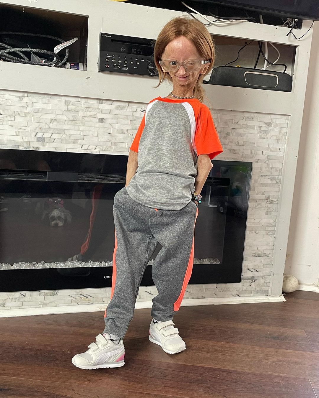 Erken yaşlanan ünlü Youtuber'dan acı haber! Adalia Rose Williams 15 yaşında hayatını kaybetti 23
