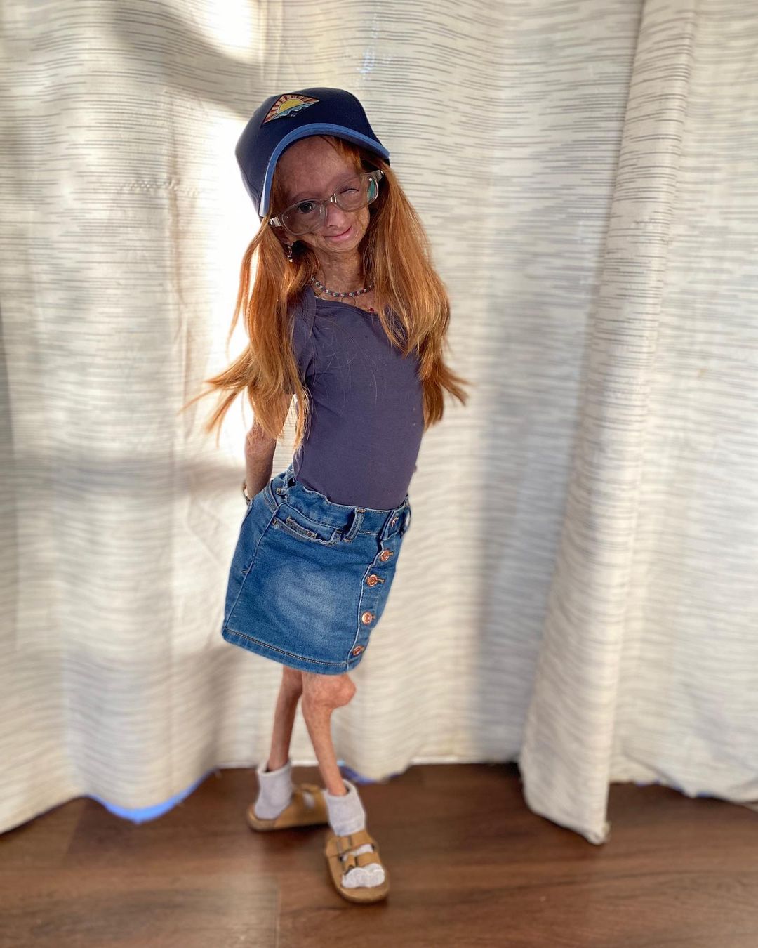 Erken yaşlanan ünlü Youtuber'dan acı haber! Adalia Rose Williams 15 yaşında hayatını kaybetti 25