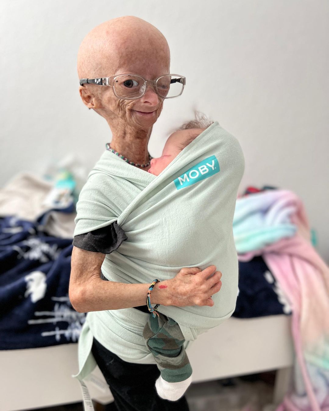 Erken yaşlanan ünlü Youtuber'dan acı haber! Adalia Rose Williams 15 yaşında hayatını kaybetti 27
