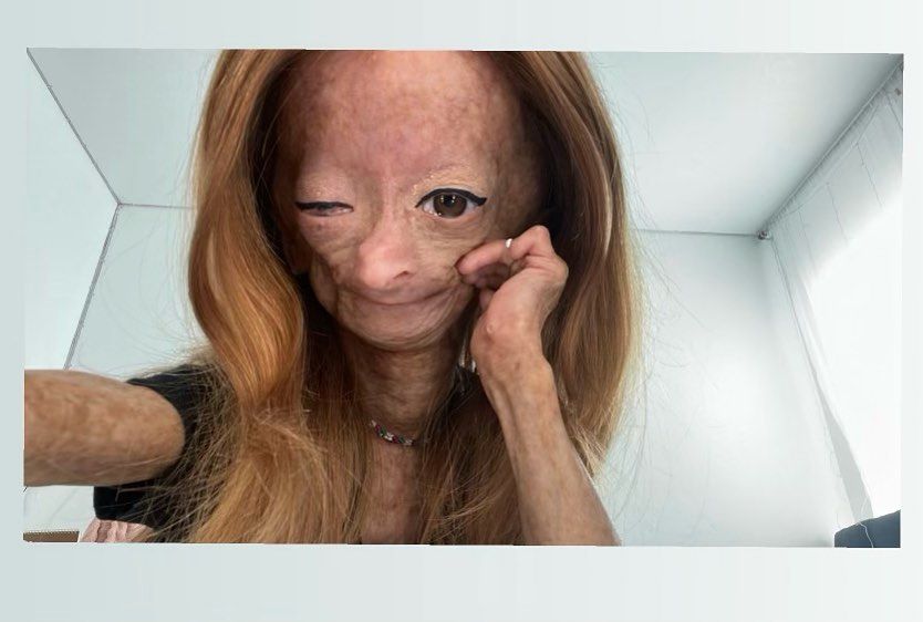 Erken yaşlanan ünlü Youtuber'dan acı haber! Adalia Rose Williams 15 yaşında hayatını kaybetti 28