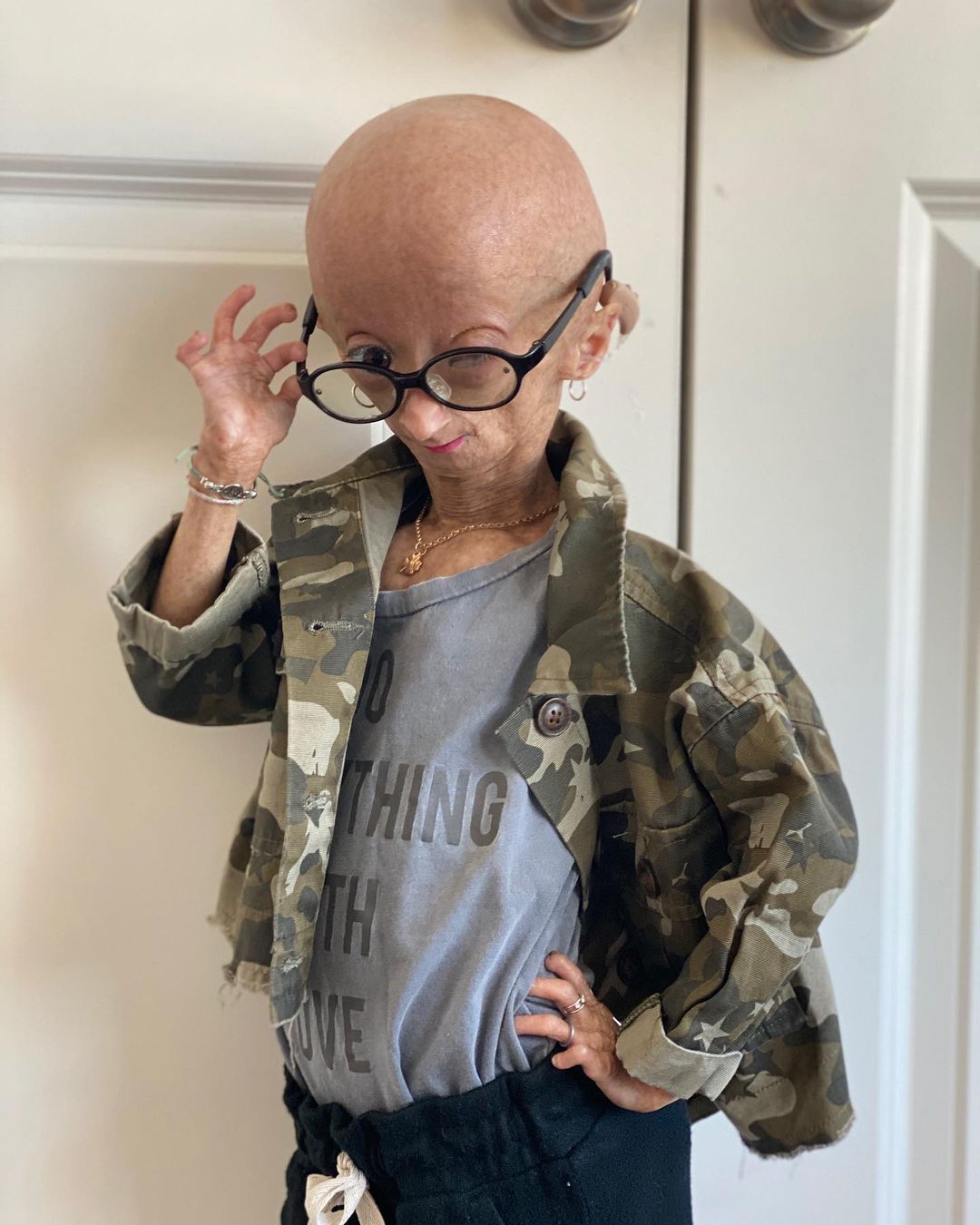 Erken yaşlanan ünlü Youtuber'dan acı haber! Adalia Rose Williams 15 yaşında hayatını kaybetti 5