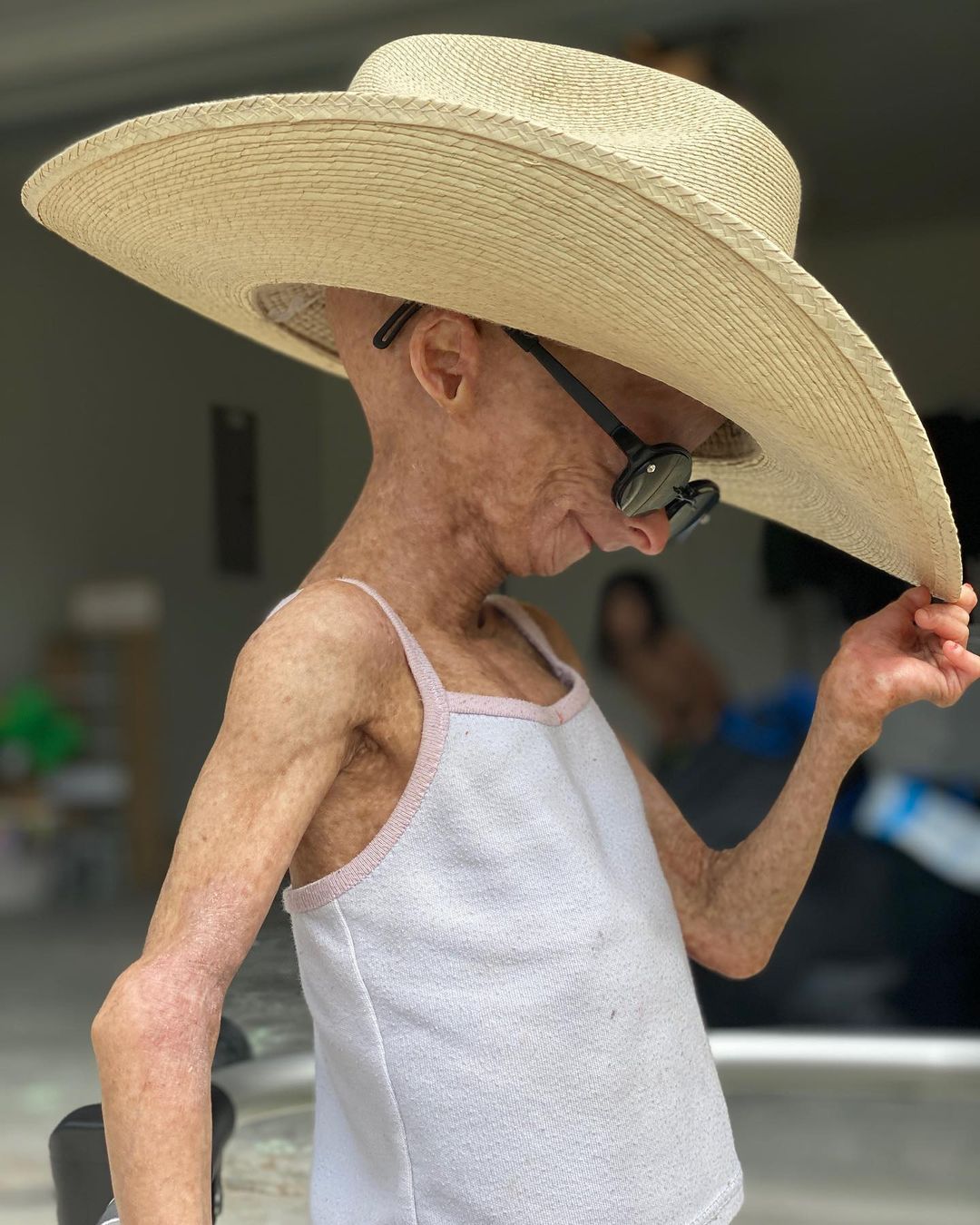 Erken yaşlanan ünlü Youtuber'dan acı haber! Adalia Rose Williams 15 yaşında hayatını kaybetti 6