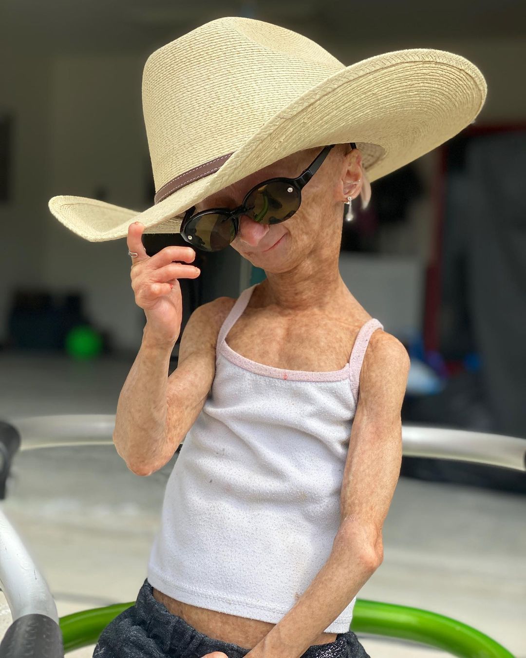 Erken yaşlanan ünlü Youtuber'dan acı haber! Adalia Rose Williams 15 yaşında hayatını kaybetti 7