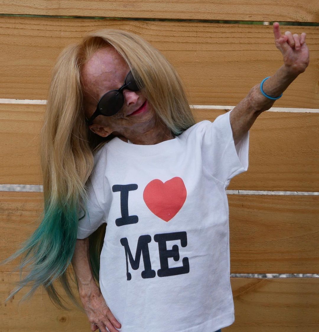 Erken yaşlanan ünlü Youtuber'dan acı haber! Adalia Rose Williams 15 yaşında hayatını kaybetti 8
