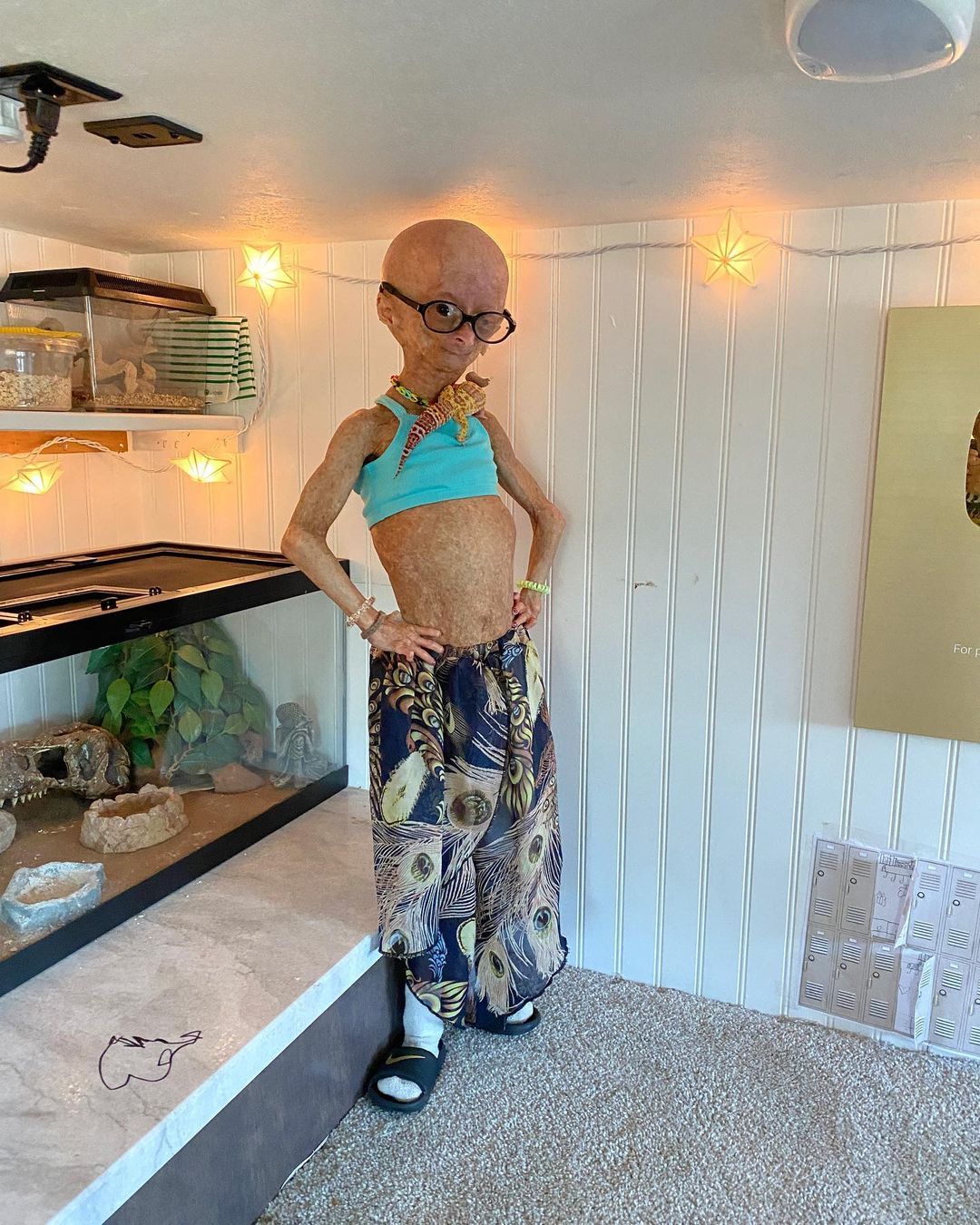 Erken yaşlanan ünlü Youtuber'dan acı haber! Adalia Rose Williams 15 yaşında hayatını kaybetti 9