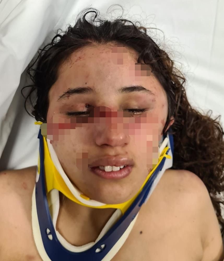 7 aylık hamile eşe akılalmaz işkence: İple bağlayıp vücudunda sigara söndürdü! 5