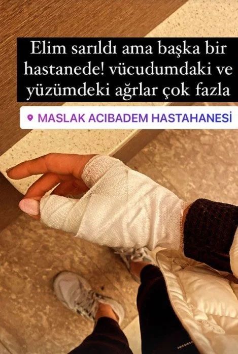 Özer Hurmacı'nın Eşi Mihriban Hurmacı Yaşadığı Skandal Darp Görüntülerini Paylaştı! 2