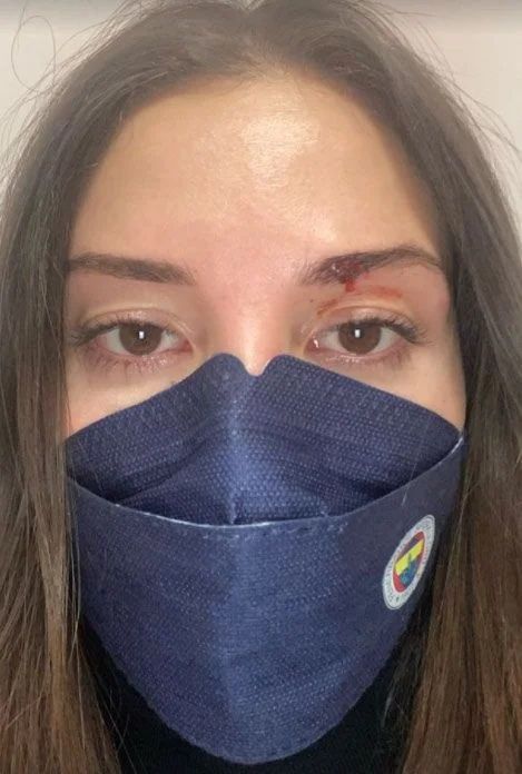 Özer Hurmacı'nın Eşi Mihriban Hurmacı Yaşadığı Skandal Darp Görüntülerini Paylaştı! 6