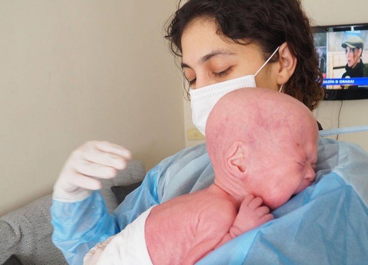 Türkiye'nin yılan bebeği Gökdeniz 1 yaşında: Annesi ilk kez öpebildi! 4