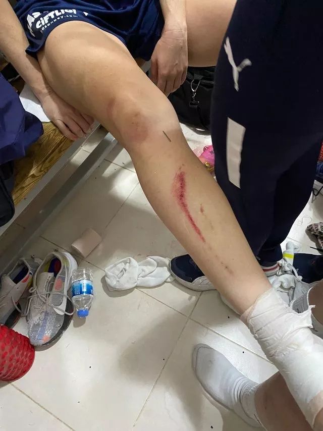 Fenerbahçe - Amed kavgasının perde arkası... "10 kişi üzerime çullandı" 10