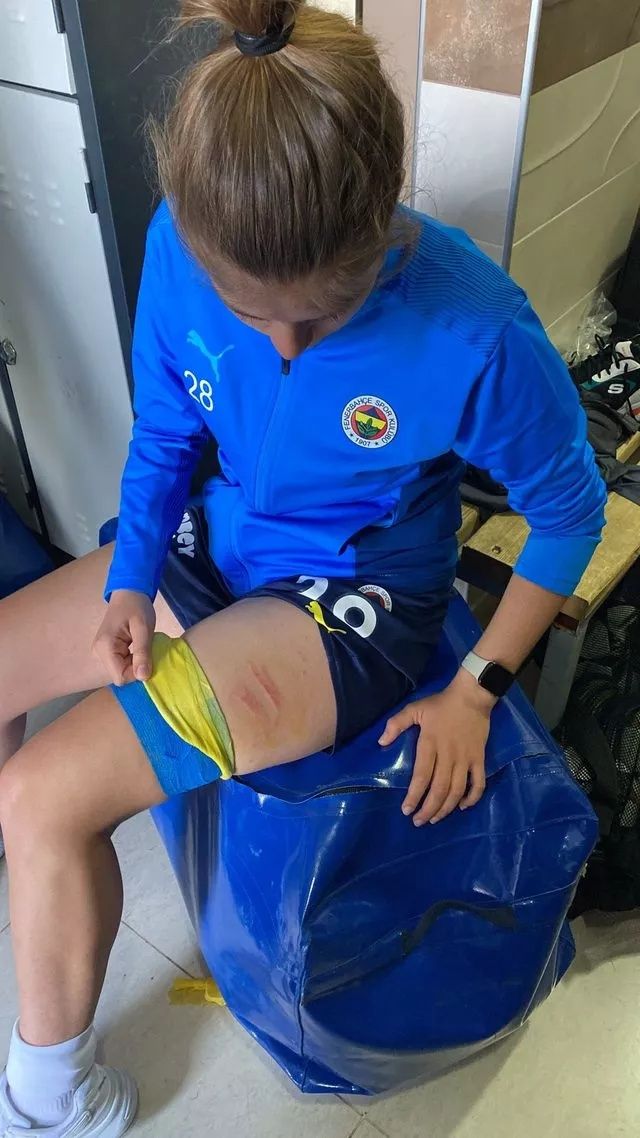 Fenerbahçe - Amed kavgasının perde arkası... "10 kişi üzerime çullandı" 8