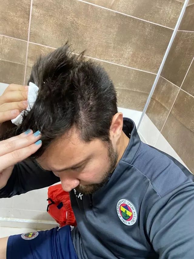 Fenerbahçe - Amed kavgasının perde arkası... "10 kişi üzerime çullandı" 7