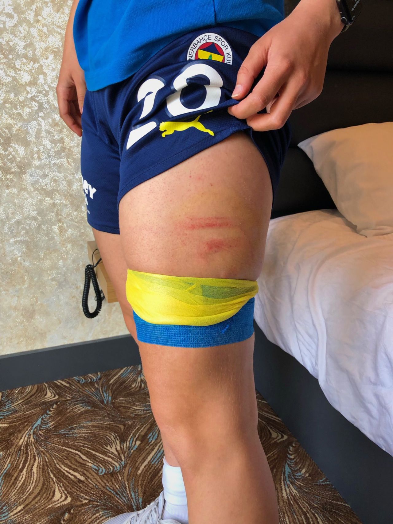 Fenerbahçe - Amed kavgasının perde arkası... "10 kişi üzerime çullandı" 1
