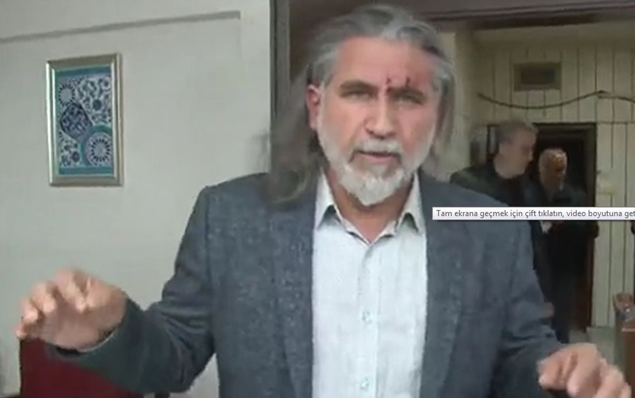 MHP'den istifa eden iş insanı Sedat Kılınç stüdyoda saldırıya uğradı 5