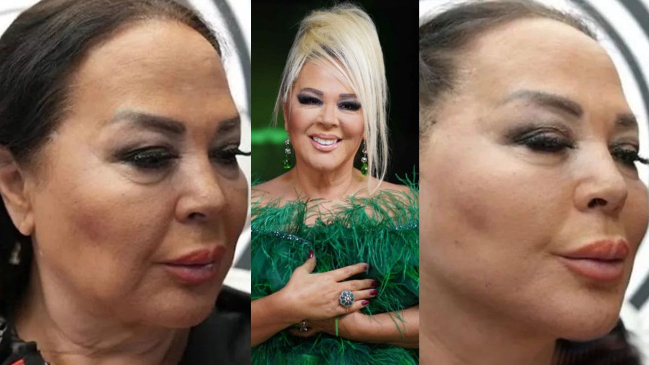 Listenin başında Seda Sayan var! İşte Fransız Askısı estetiği yaptıran ünlü isimler 9