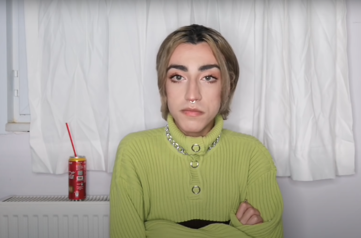 Sosyal medya fenomeni Mika Can Raun estetik operasyon geçirdi! Bambaşka bir yüze sahip oldu 7