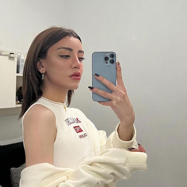 Sosyal medya fenomeni Mika Can Raun estetik operasyon geçirdi! Bambaşka bir yüze sahip oldu 15