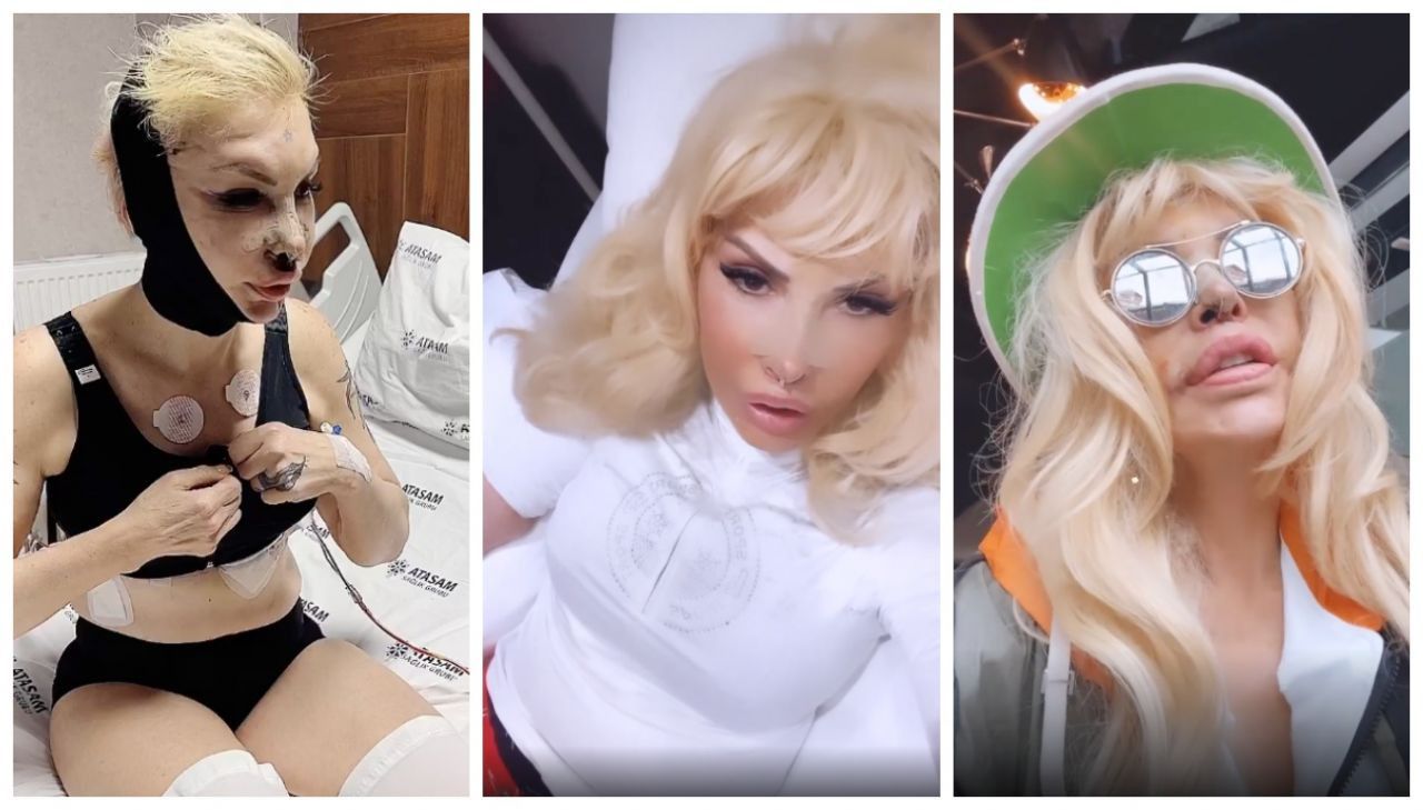 Filiz Akın'a benzemek için estetik operasyon geçiren Seyhan Soylu son haliyle 'yok artık' dedirtti 1