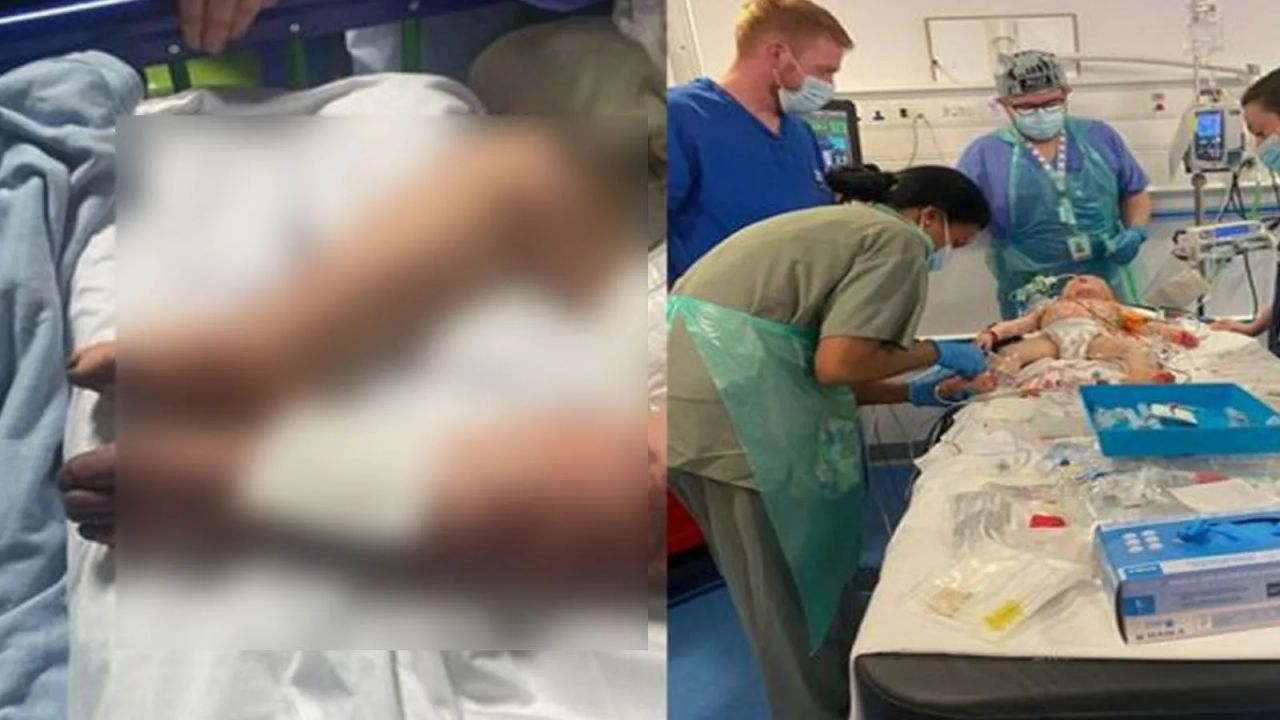 Annesi kızamık zannetti, gerçek bambaşka çıktı: Parmaklarını kaybedebilir! 2