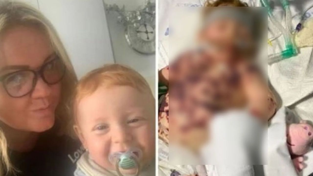 Annesi kızamık zannetti, gerçek bambaşka çıktı: Parmaklarını kaybedebilir! 3