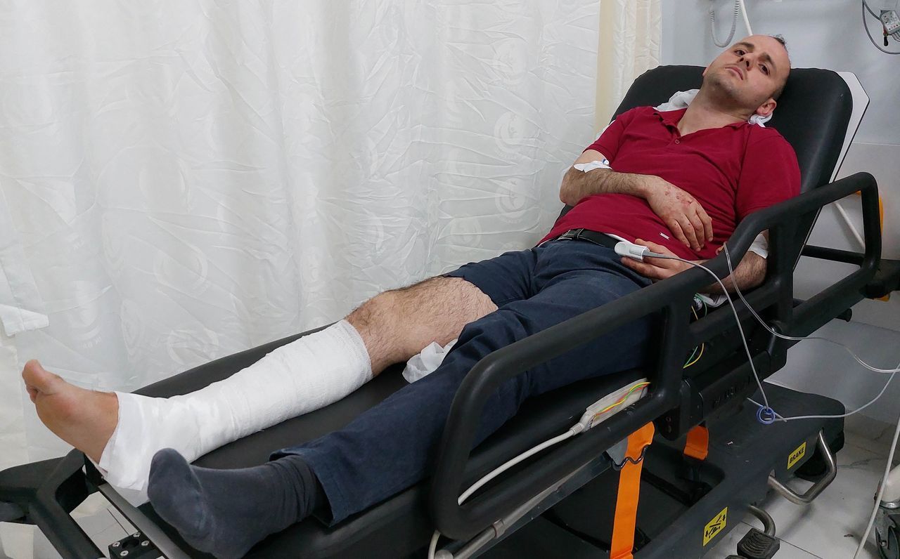 Manavda önce silahlı çatışma, sonra kundaklama: 3'ü ağır 5 yaralı 7