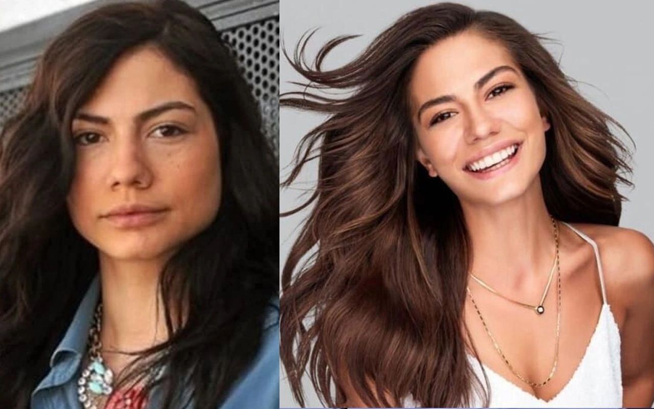 Ünlülerin hayatlarını estetik değiştirdi! Pınar Deniz, Gülsüm Ali, Melek Mosso estetiksiz halleri 2