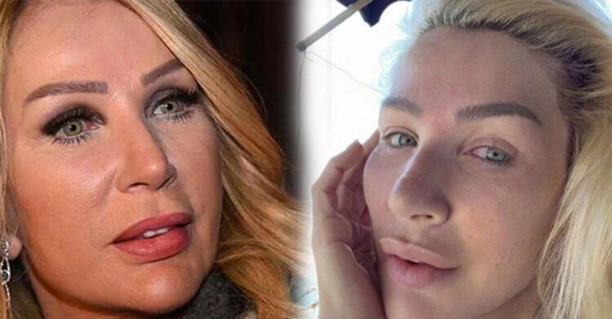 Ünlülerin hayatlarını estetik değiştirdi! Pınar Deniz, Gülsüm Ali, Melek Mosso estetiksiz halleri 6