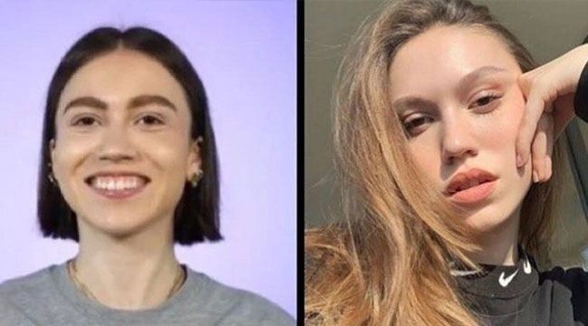 Ünlülerin hayatlarını estetik değiştirdi! Pınar Deniz, Gülsüm Ali, Melek Mosso estetiksiz halleri 7